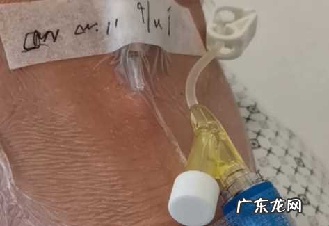 恶性胰腺肿瘤能治好吗 胰腺肿瘤能治好吗?