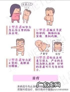 粘脂质贮积症寿命多长 粘脂质贮积症是啥病