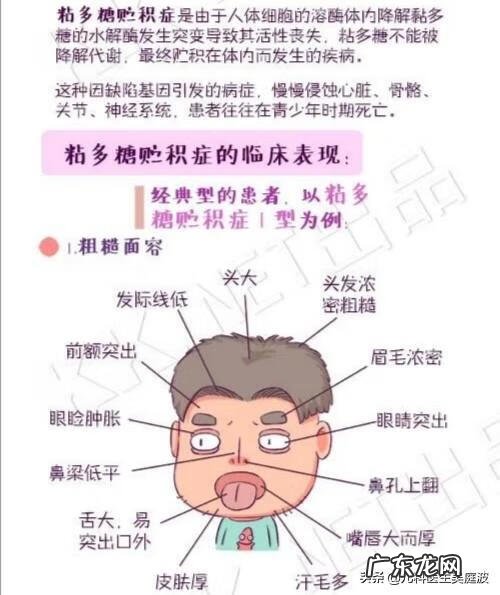 粘脂质贮积症寿命多长 粘脂质贮积症是啥病