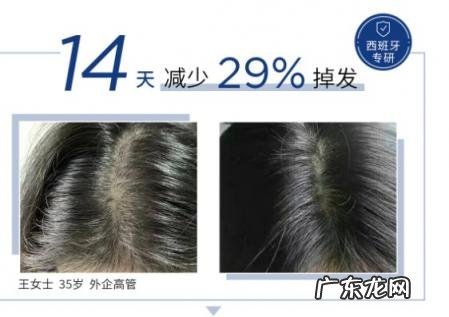 瓦尔格生发液 瓦尔格头皮精华液怎么样好用吗