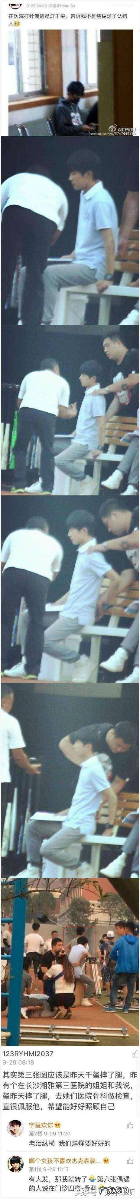 大拇指有疤代表什么 大拇指上有疤