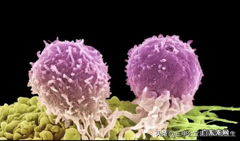 十大不致命癌症是什么?