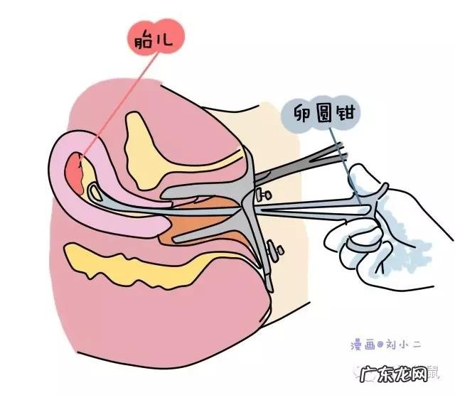 刨腹产四年后又怀孕了，药流和人流哪个好？
