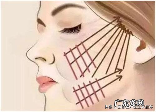 如何进行面部提升？