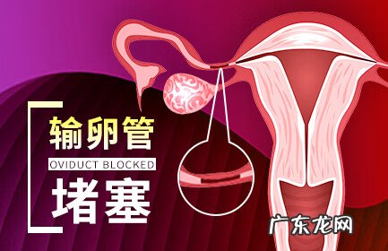 输卵管堵塞有什么样症状 输卵管不通的症状表现
