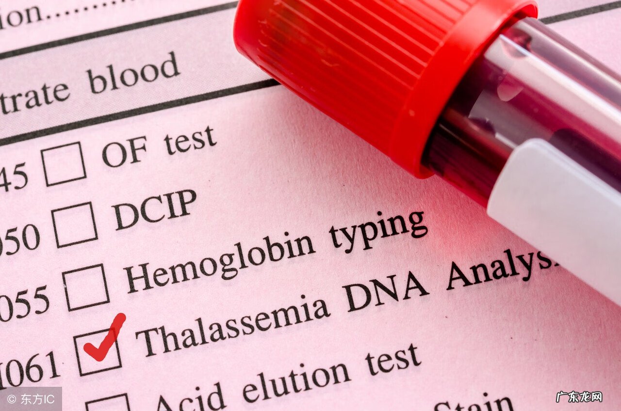 地贫症状的外表特征 地贫症状有哪些