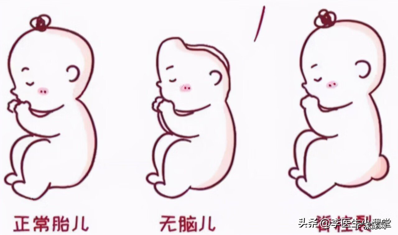 每天一片叶酸会有副作用吗 长期吃叶酸有副作用吗?