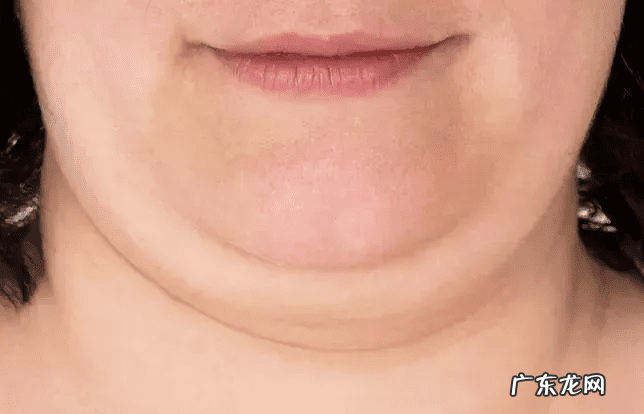 双下巴如何处理 长双下巴怎么办?