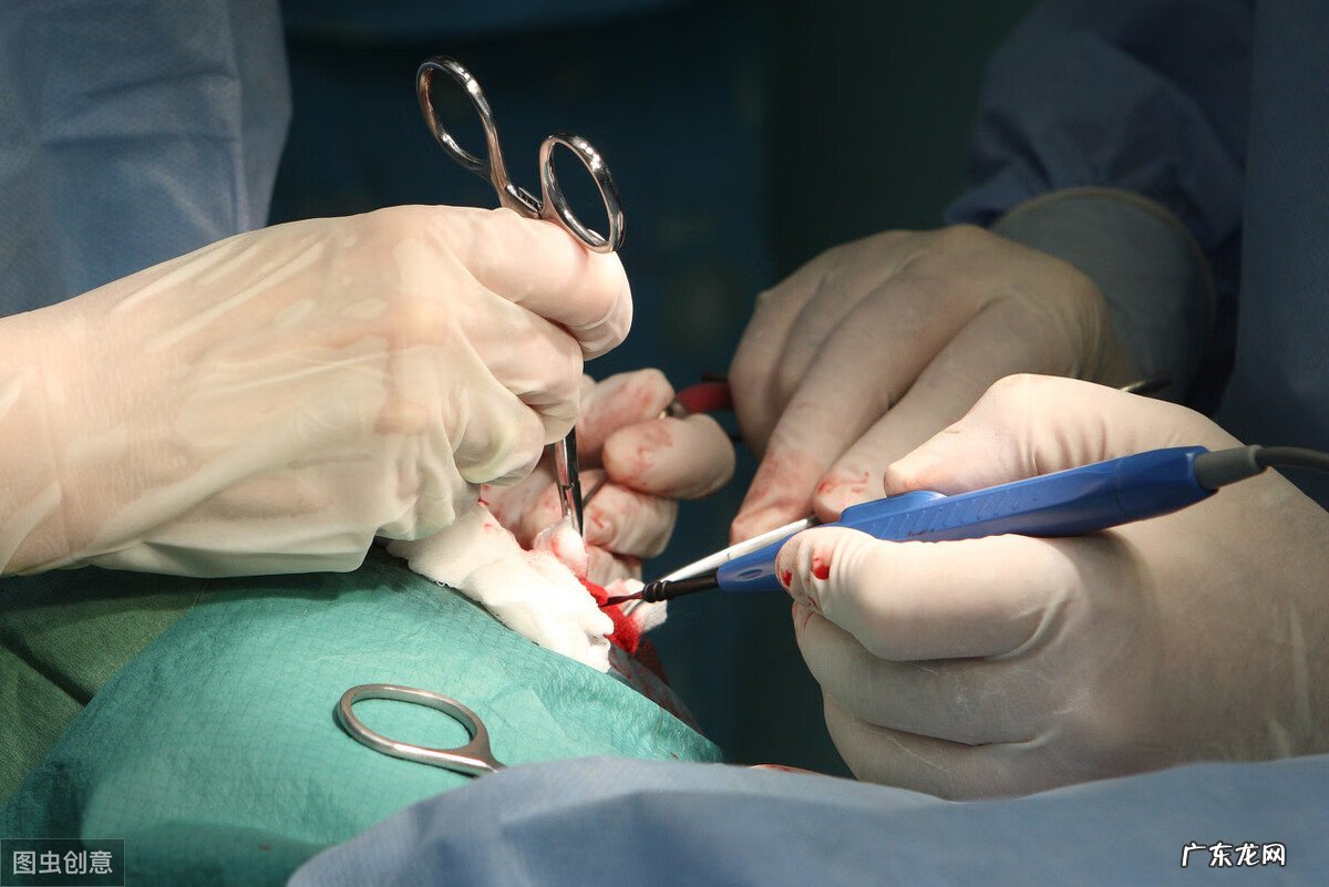 斜视是怎么矫正的 斜视矫正手术