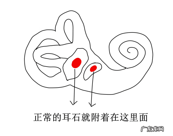 耳石症的原因 耳石症是怎么造成的