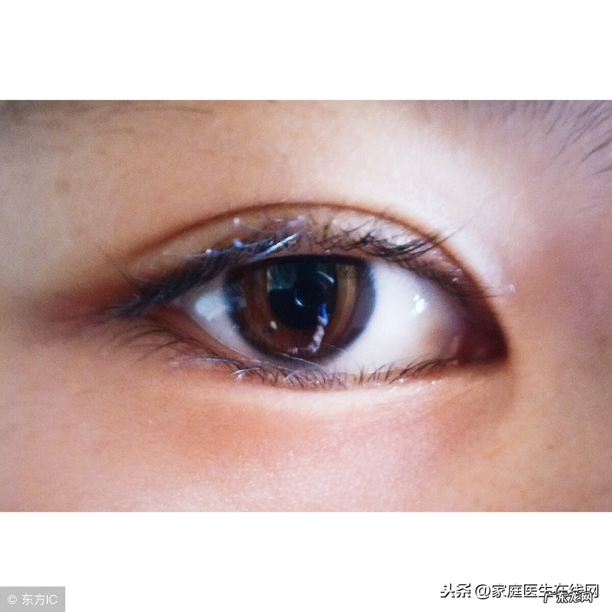 左眼皮跳是什么预兆 左眼一直翻风水角度怎么回事