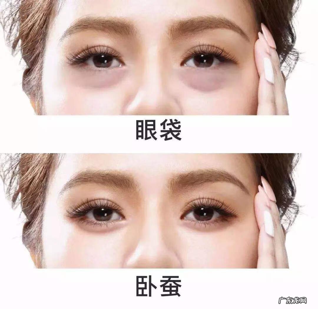 孩子有下眼袋 眼袋大对子女好吗?