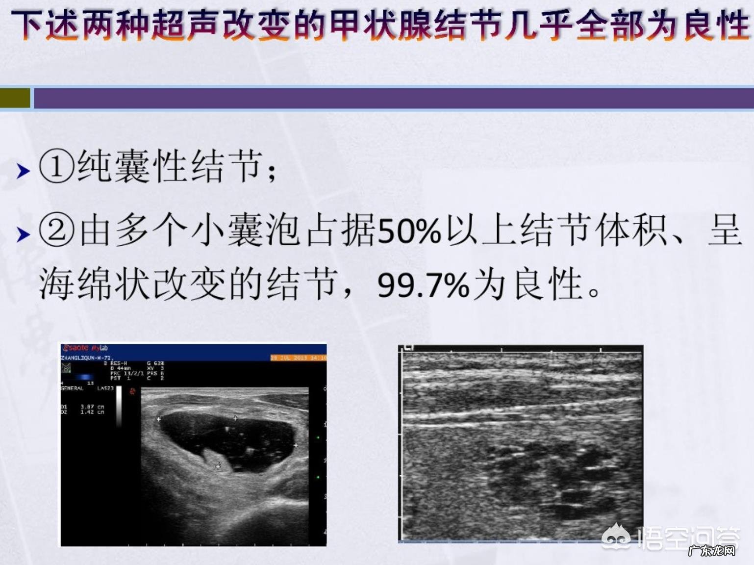#秋补#如何通过饮食调理甲状腺结节?