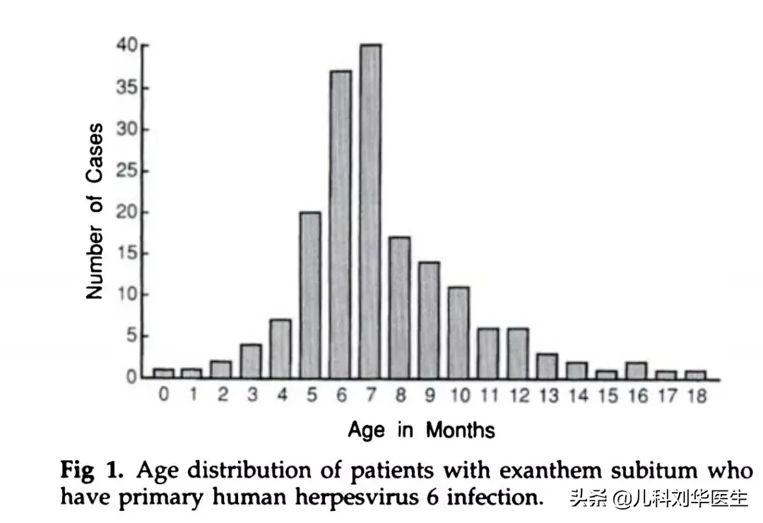 幼儿急疹最简单判断方法 幼儿急疹图片