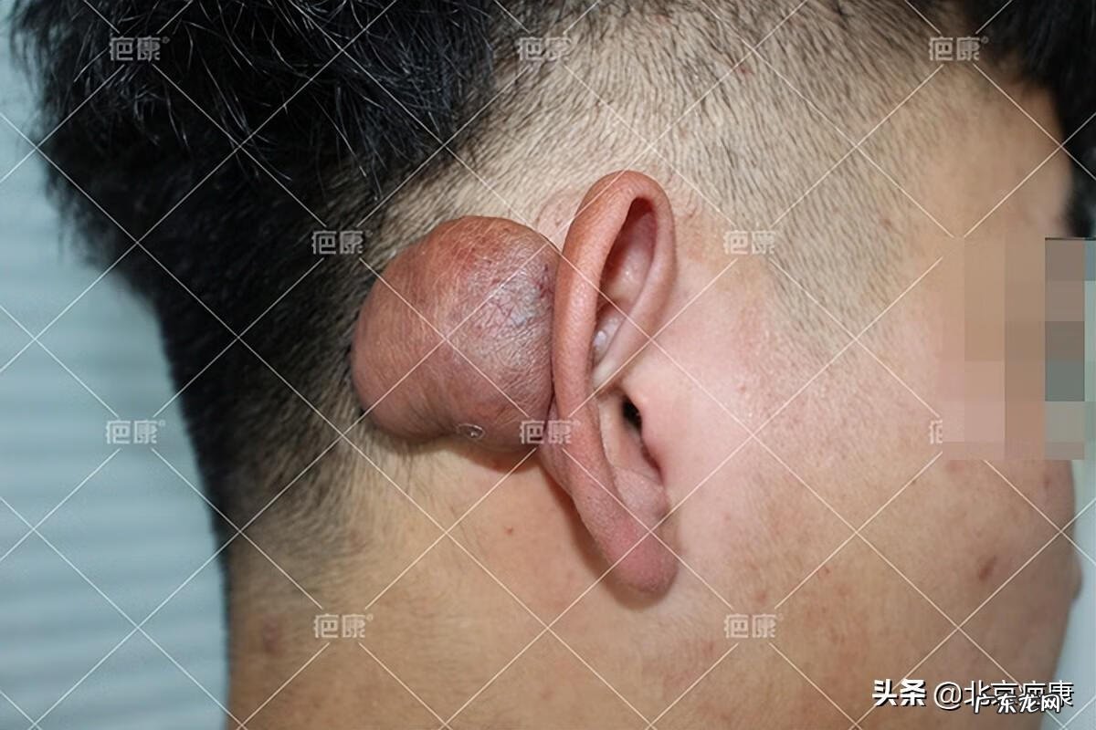 左额头有疤痕面相 头上有疤的图片