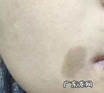 面部长斑图片大全