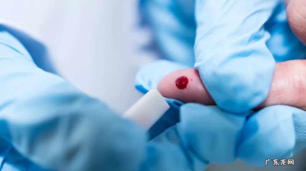 艾滋病免费咨询平台 艾滋网站