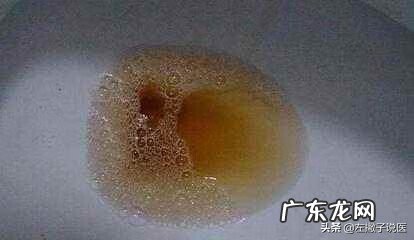 小便发黄是什么问题 小便发黄是什么原因