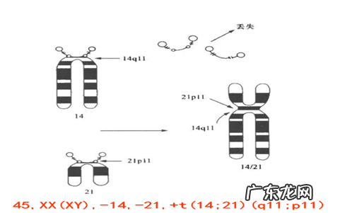 胎儿染色体异常会怎样 胎儿染色体异常有什么影响
