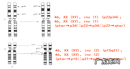 胎儿染色体异常会怎样 胎儿染色体异常有什么影响