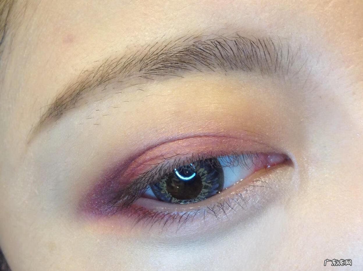 眼睛一直肿是怎么回事 眼睛肿是怎么回事儿