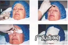 刷酸能祛痘和痘印还能美白,到底过程是怎样的?