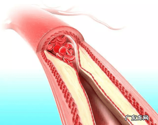 睡觉手麻是什么病的预兆 睡觉手麻是什么回事?