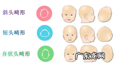 畸形图片 畸形婴儿图片