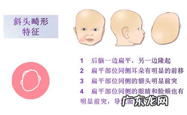 畸形图片 畸形婴儿图片