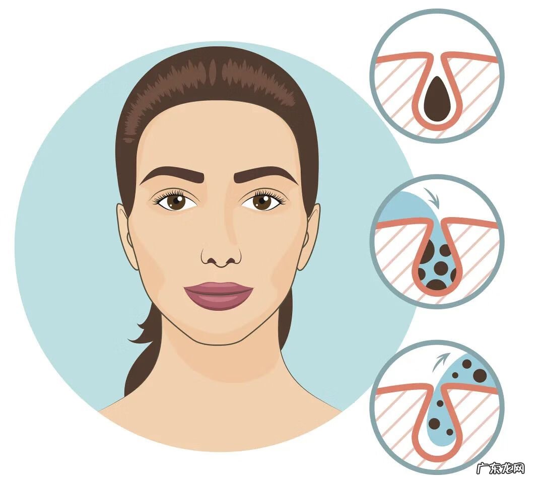 祛痘产品 美容祛痘图片