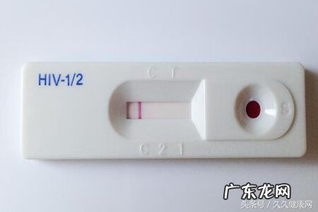 艾滋病的早期表现及症状 艾滋的早期症状有哪些?