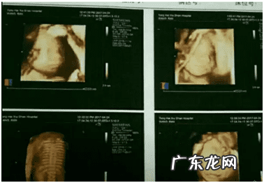做性别鉴定通过什么方法 宝宝性别鉴定方法