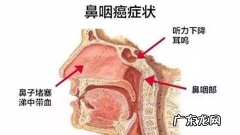 肝癌会传染给家人吗? 肺癌肝癌传染吗