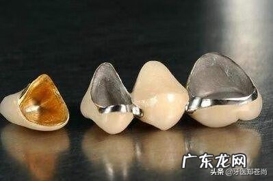 年轻人做烤瓷牙好不好 烤瓷牙好不好用