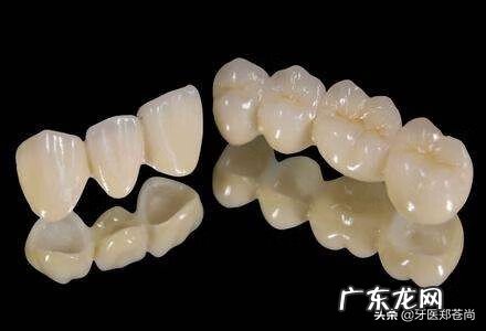 年轻人做烤瓷牙好不好 烤瓷牙好不好用