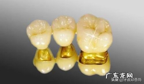 年轻人做烤瓷牙好不好 烤瓷牙好不好用