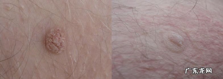 普通蜗牛是否可以美容 蜗牛美容有效果吗