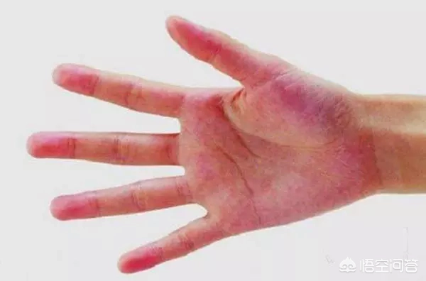 什么食物是肝脏的“保镖”，吃半个月，降酶护肝？