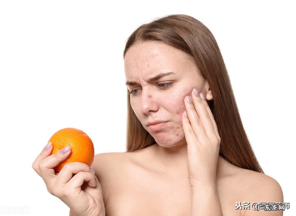 皮肤过敏用什么可以缓解 皮肤过敏该怎么办呀