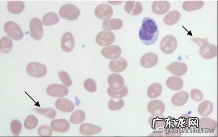 维生素b12哪些食物最多 维生素b12的作用和功效