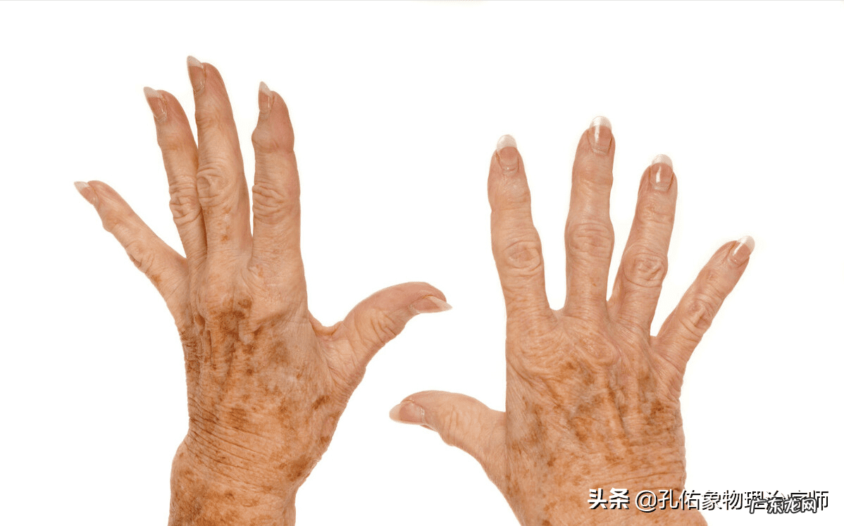 凸起的老年斑怎么去掉 为什么会有老年斑怎么去掉