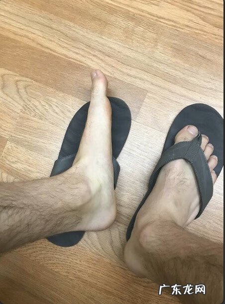 基因遗传 遗传基因的神奇