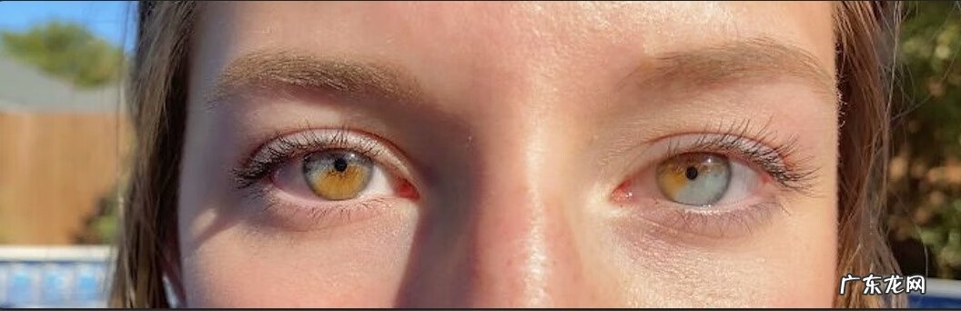 基因遗传 遗传基因的神奇