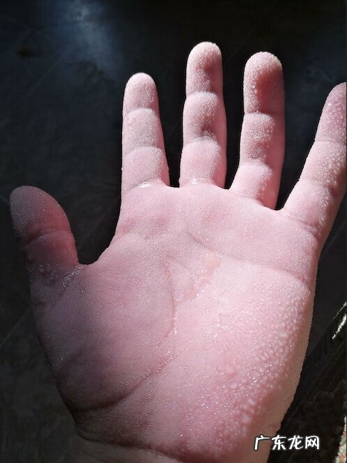 基因遗传 遗传基因的神奇