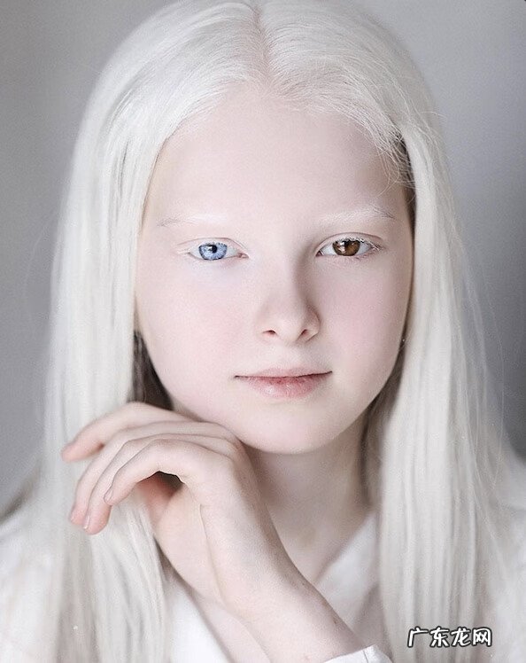 基因遗传 遗传基因的神奇