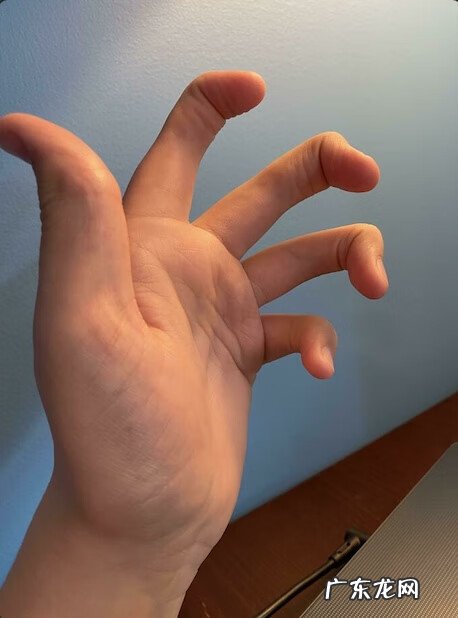 基因遗传 遗传基因的神奇