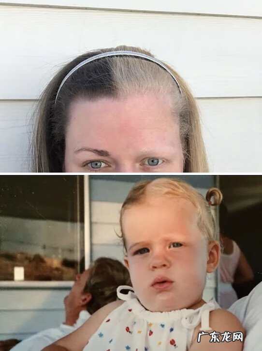 基因遗传 遗传基因的神奇