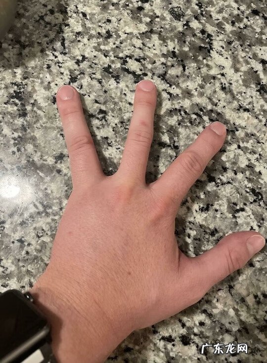 基因遗传 遗传基因的神奇