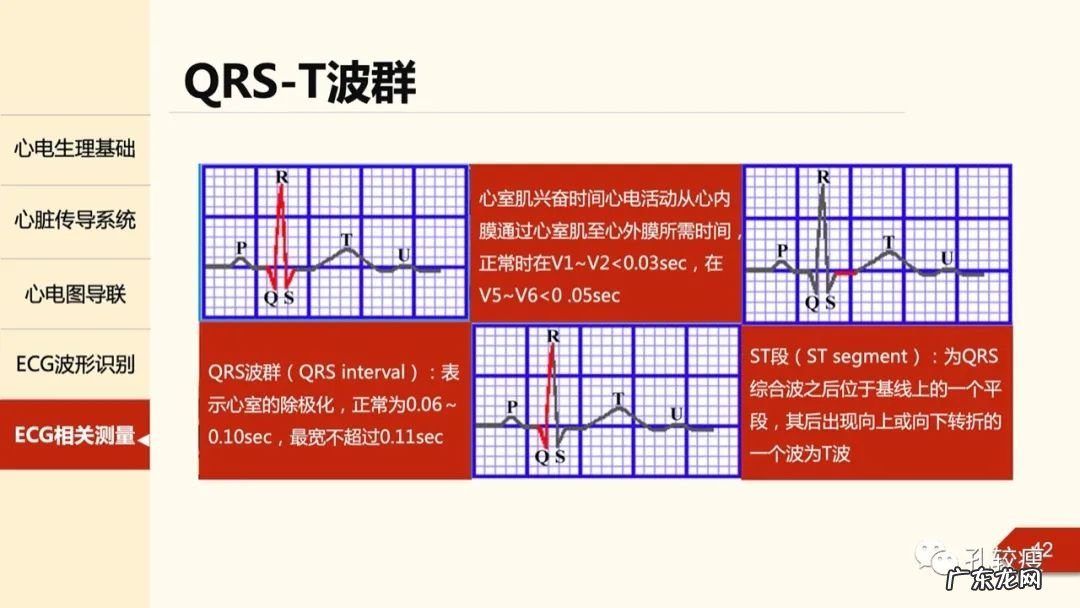 心电图机导联位置图 心电图导联位置示意图