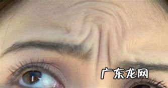 年纪轻轻就有眉间纹该怎么办?